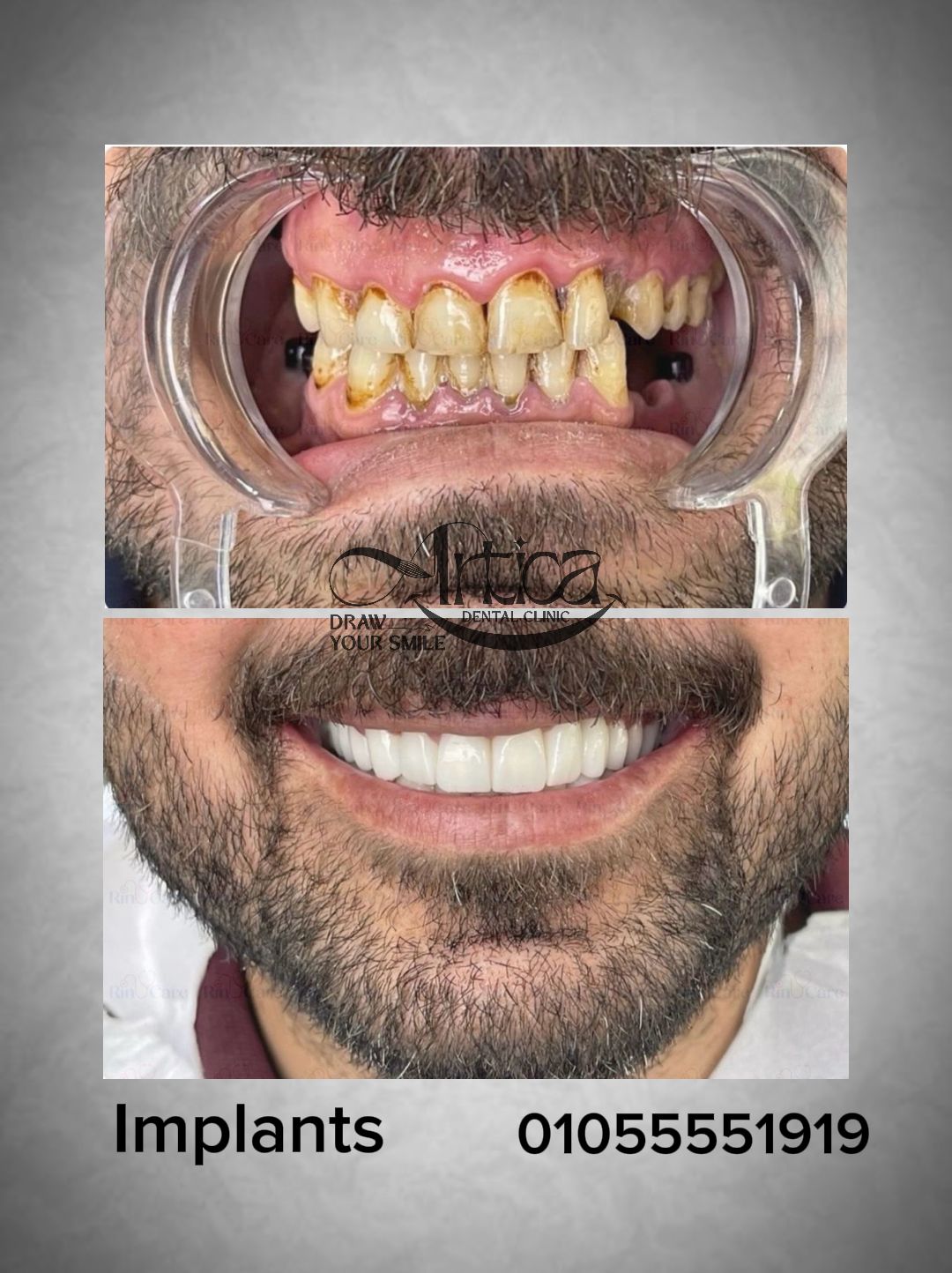 WhatsApp Image 2026-02-13 at 8.54.00 PM (2)